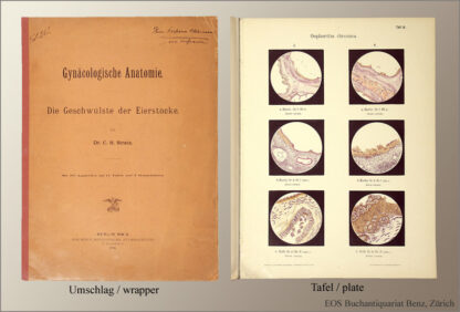 Stratz, C(arl) H(einrich): -Die Geschwülste der Eierstöcke.
