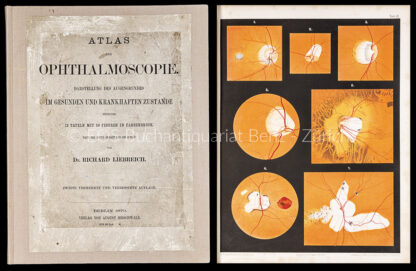 Liebreich, Richard: -Atlas der Ophtalmoscopie.