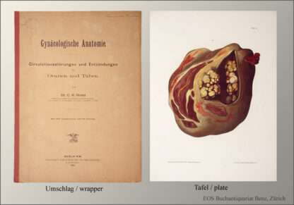 Stratz, C(arl) H(einrich): -Circulationsstörungen und Entzündungen der Ovarien und Tuben.