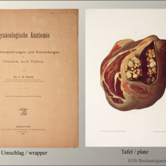 Stratz, C(arl) H(einrich): -Circulationsstörungen und Entzündungen der Ovarien und Tuben.