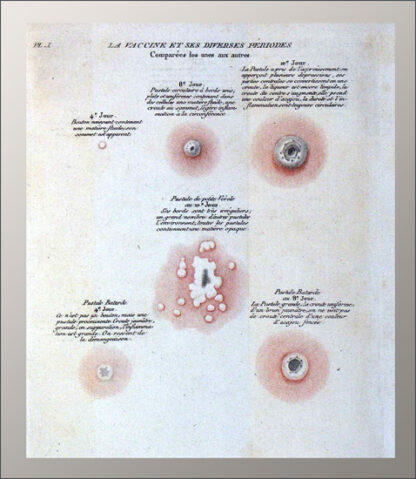 Thornton, John:  Preuves de l'efficacité de la vaccine, – Bild 2