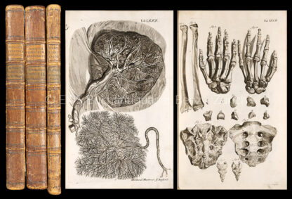 Manget, Jean Jacques: -Theatrum anatomicum...